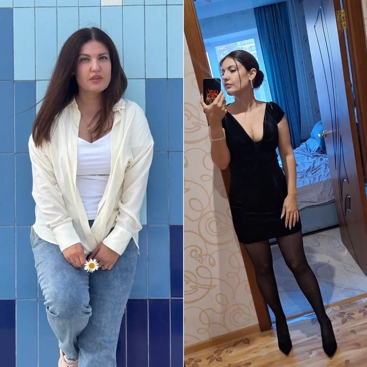 Микродермабразия